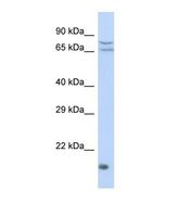 Western blot of Human HepG2. ZNF195 antibody dilution 1.0 ug/ml.