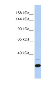 ZNF197 antibody LS-C101572 Western blot of Fetal Heart lysate.