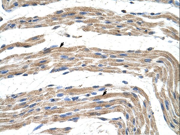 ZNF197 antibody LS-C30376 was used in IHC to stain formalin-fixed, paraffin-embedded human muscle.