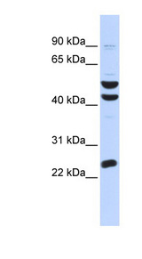 ZNF200 antibody LS-C110263 Western blot of OVCAR-3 cell lysate.