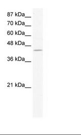 K562 Cell Lysate