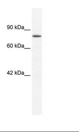 Jurkat Cell Lysate