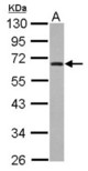 Sample (30 ug of whole cell lysate) A: A431 10% SDS PAGE ZNF215 antibody diluted at 1:1000