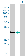 Western Blot analysis of ZNF215 expression in transfected 293T cell line by ZNF215 monoclonal antibody (M01), clone 2C11.Lane 1: ZNF215 transfected lysate(35.3 KDa).Lane 2: Non-transfected lysate.