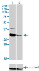 Western blot analysis of ZNF215 over-expressed 293 cell line, cotransfected with ZNF215 Validated Chimera RNAi (Lane 2) or non-transfected control (Lane 1). Blot probed with ZNF215 monoclonal antibody (M01), clone 2C11 . GAPDH ( 36.1 kDa ) used as specificity and loading control.