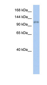 ZNF217 antibody LS-C109809 Western blot of Fetal stomach lysate.