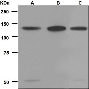 Western blot analysis on (A) MCF-7, (B) PC-3, (C) Caco-2 cell lysates using anti-ZNF217 antibody.