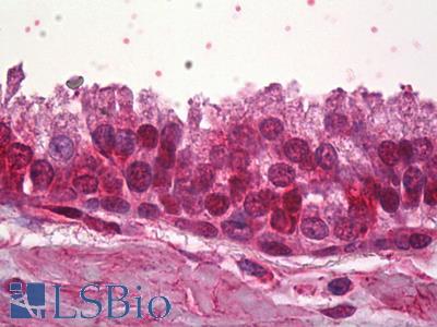 Anti-ZNF217 antibody IHC of human prostate. Immunohistochemistry of formalin-fixed, paraffin-embedded tissue after heat-induced antigen retrieval. Antibody LS-B6869 concentration 5 ug/ml.
