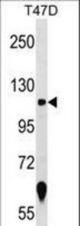 ZNF217 Antibody western blot of T47D cell line lysates (35 ug/lane). The ZNF217 antibody detected the ZNF217 protein (arrow).