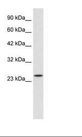 Jurkat Cell Lysate