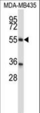 ZNF222 Antibody (N-term ) western blot of MDA-MB435 cell line lysates (35 ug/lane). The ZNF222 antibody detected the ZNF222 protein (arrow).