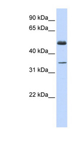 ZNF223 antibody LS-C110082 Western blot of Fetal Muscle lysate.