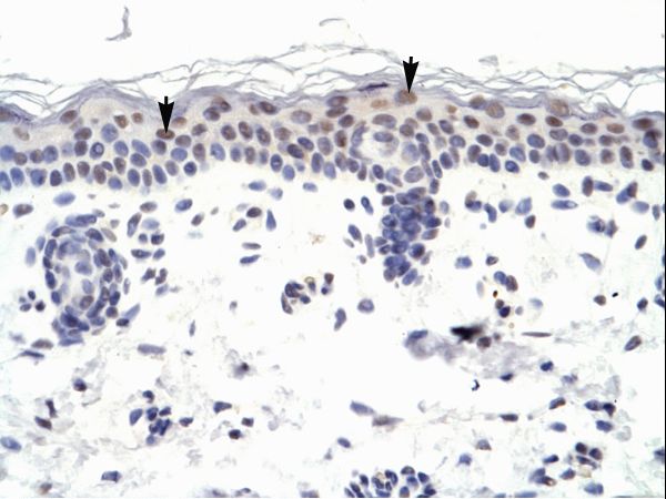 ZNF223 antibody LS-C29986 was used in IHC to stain formalin-fixed, paraffin-embedded human skin.