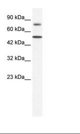 Jurkat Cell Lysate