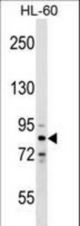 ZNF224 Antibody western blot of HL-60 cell line lysates (35 ug/lane). The ZNF224 antibody detected the ZNF224 protein (arrow).