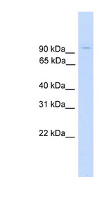 ZNF224 antibody LS-C116790 Western blot of Fetal Muscle lysate.
