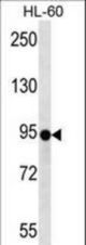 ZNF227 Antibody (N-term ) western blot of HL-60 cell line lysates (35 ug/lane). The ZNF227 antibody detected the ZNF227 protein (arrow).