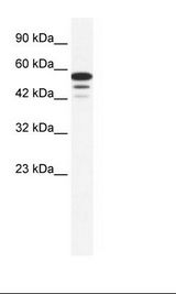 Jurkat Cell Lysate