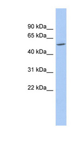 ZNF230 antibody LS-C110070 Western blot of NCI-H226 cell lysate.