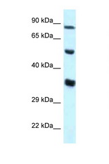 ZNF232 antibody LS-C145638 Western blot of HepG2 Cell lysate. Antibody concentration 1 ug/ml.