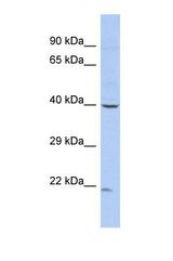 Western blot of Human COLO205. ZNF232 antibody dilution 1.0 ug/ml.