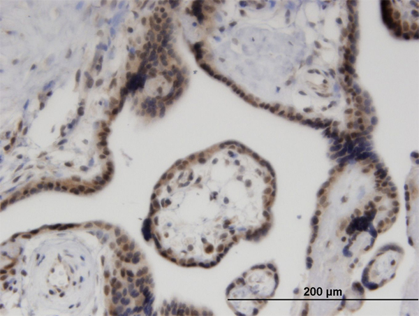Immunoperoxidase of monoclonal antibody to ZNF232 on formalin-fixed paraffin-embedded human placenta. [antibody concentration 3 ug/ml]