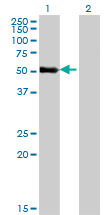 Western blot of ZNF232 expression in transfected 293T cell line by ZNF232 monoclonal antibody (M06), clone 1F8.