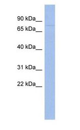 ZNF233 antibody Western Blot of Human Thymus.