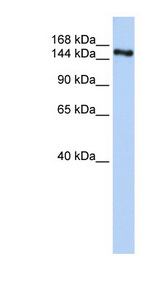 ZNF236 antibody LS-C110335 Western blot of Fetal Brain lysate.