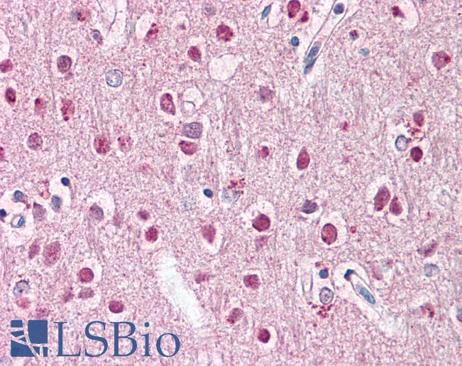 Anti-ZNF238 antibody IHC of human brain, cortex. Immunohistochemistry of formalin-fixed, paraffin-embedded tissue after heat-induced antigen retrieval. Antibody LS-B8070 dilution 5-10 ug/ml.