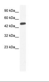 Jurkat Cell Lysate