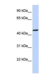 ZNF239 antibody LS-C101654 Western blot of Fetal Brain lysate.
