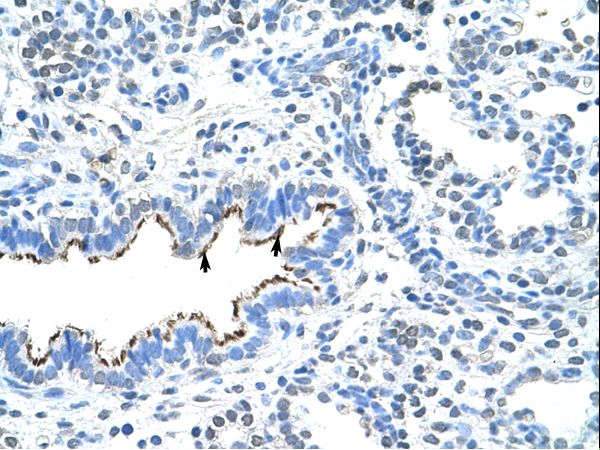 ZNF239 antibody LS-C30459 was used in IHC to stain formalin-fixed, paraffin-embedded human lung.