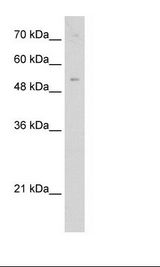 Jurkat Cell Lysate