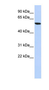 ZNF248 antibody LS-C101588 Western blot of HepG2 cell lysate.