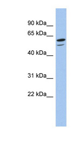 ZNF248 antibody LS-C110104 Western blot of COLO205 cell lysate.