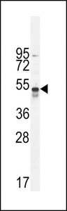 hTNFR-pS274 western blot of A549 cell line lysates (35 ug/lane). The TNFR antibody detected the TNFR protein (arrow).