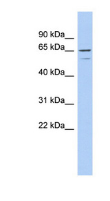 TNFRSF1A / TNFR1 antibody LS-C112271 Western blot of DU145 cell lysate.