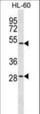 ZNF324 Antibody western blot of HL-60 cell line lysates (35 ug/lane). The ZNF324 antibody detected the ZNF324 protein (arrow).