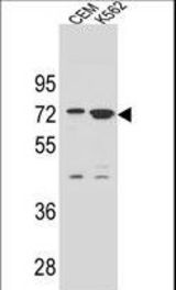 ZNF324B Antibody western blot of CEM and K562 cell line lysates (35 ug/lane). The ZNF324B antibody detected the ZNF324B protein (arrow).