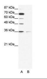 A: Marker, B: HepG2 Cell Lysate
