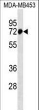 ZNF326 Antibody western blot of MDA-MB453 cell line lysates (35 ug/lane). The ZNF326 antibody detected the ZNF326 protein (arrow).