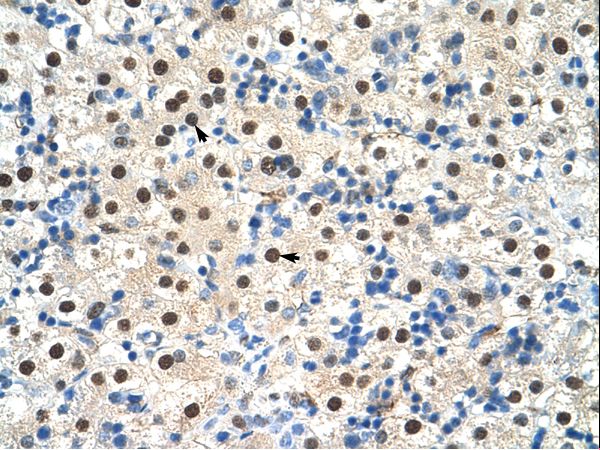 ZNF326 antibody LS-C31779 was used in IHC to stain formalin-fixed, paraffin-embedded human liver.