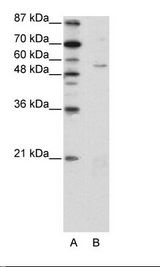 A: Marker, B: HepG2 Cell Lysate
