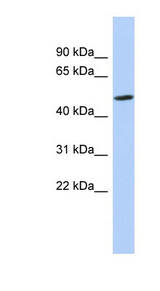 ZNF329 antibody LS-C110108 Western blot of MCF7 cell lysate.