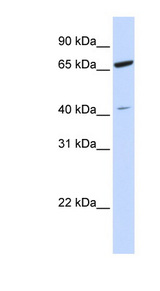 ZNF334 antibody LS-C102744 Western blot of HeLa lysate.