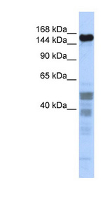 ZNF335 antibody LS-C101775 Western blot of Fetal Brain lysate.