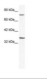 Jurkat Cell Lysate