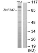Western blot of extracts from HeLa cells, using ZNF337 Antibody. The lane on the right is treated with the synthesized peptide.