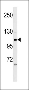ZNF33A Antibody western blot of HeLa cell line lysates (35 ug/lane). The ZNF33A Antibody detected the ZNF33A protein (arrow).